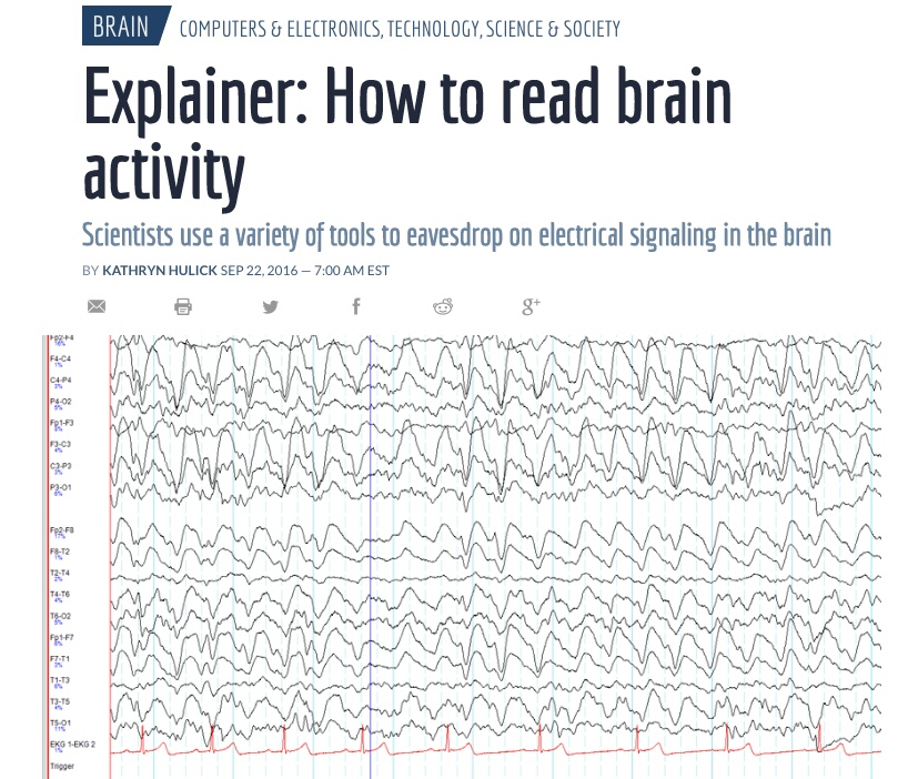 Brain-activity